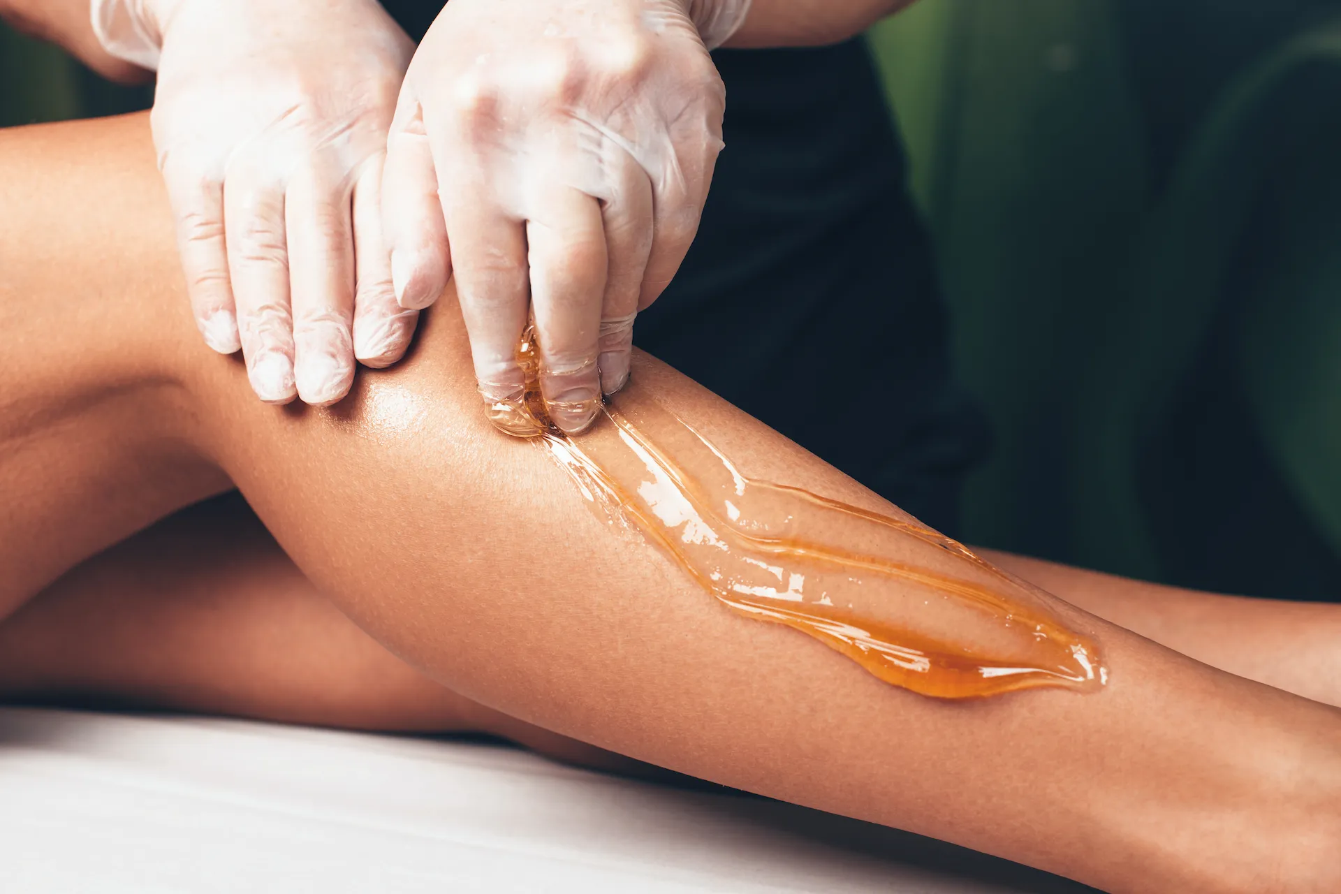 Service epilation